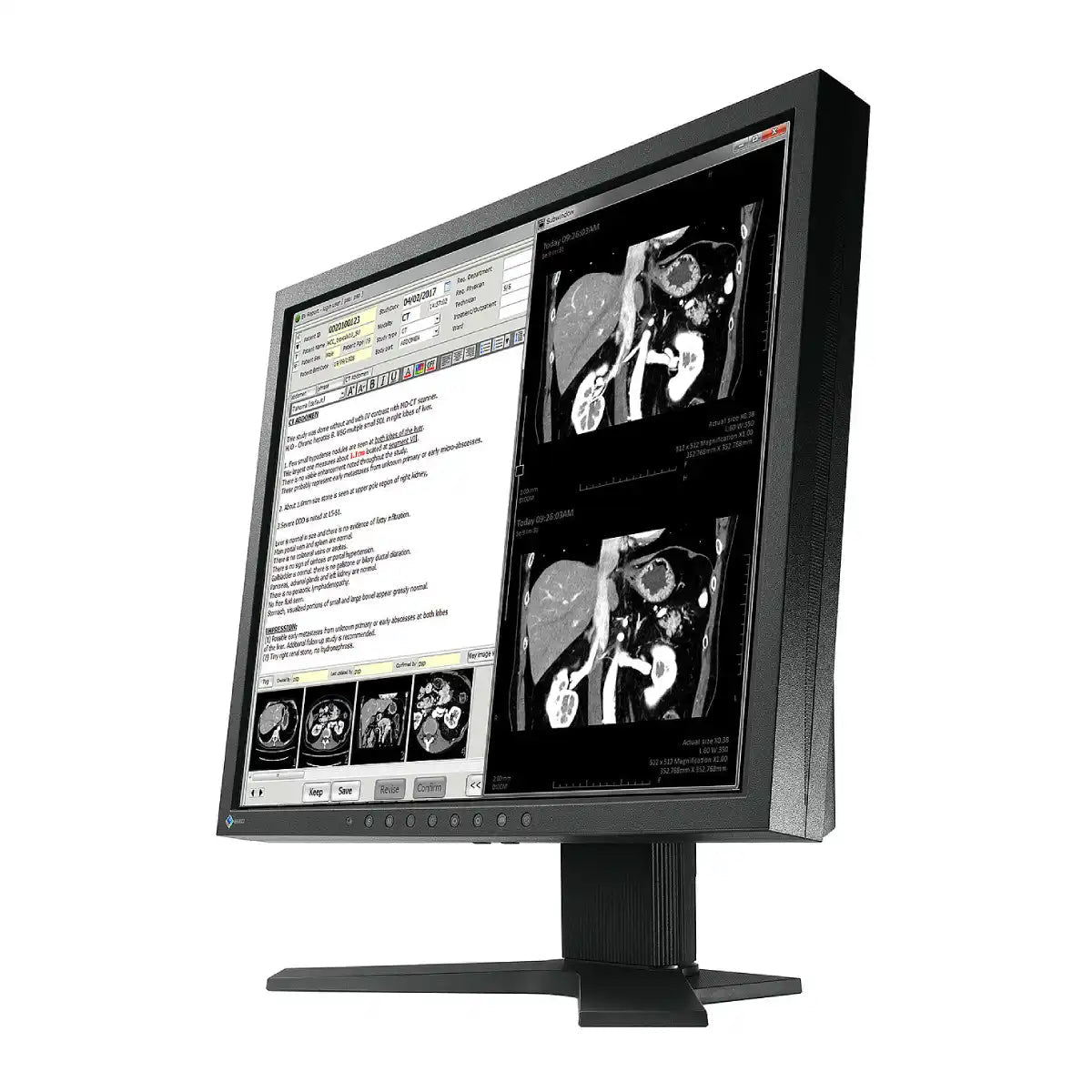 จอมอนิเตอร์ EIZO MX194 19.0" VA 1.3 Megapixels สีดำ