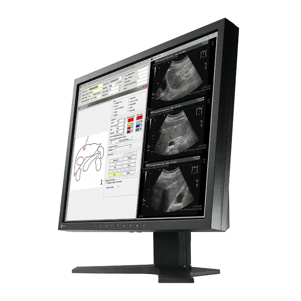 จอมอนิเตอร์ EIZO MX194 19.0" VA 1.3 Megapixels สีดำ