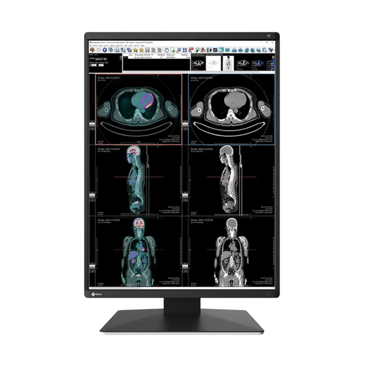 จอมอนิเตอร์ EIZO RX370 21.3" IPS 60Hz สีดำ