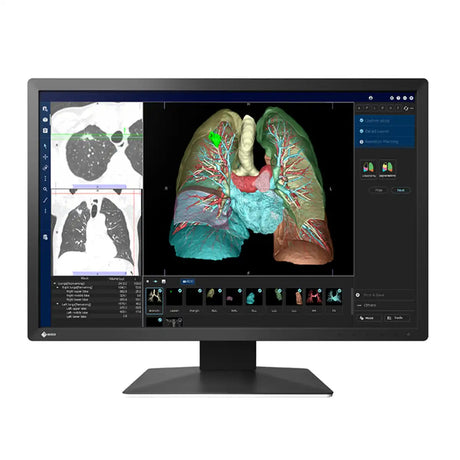 จอมอนิเตอร์ EIZO MX243W RADIFORCE 24.1" IPS 61Hz สีดำ